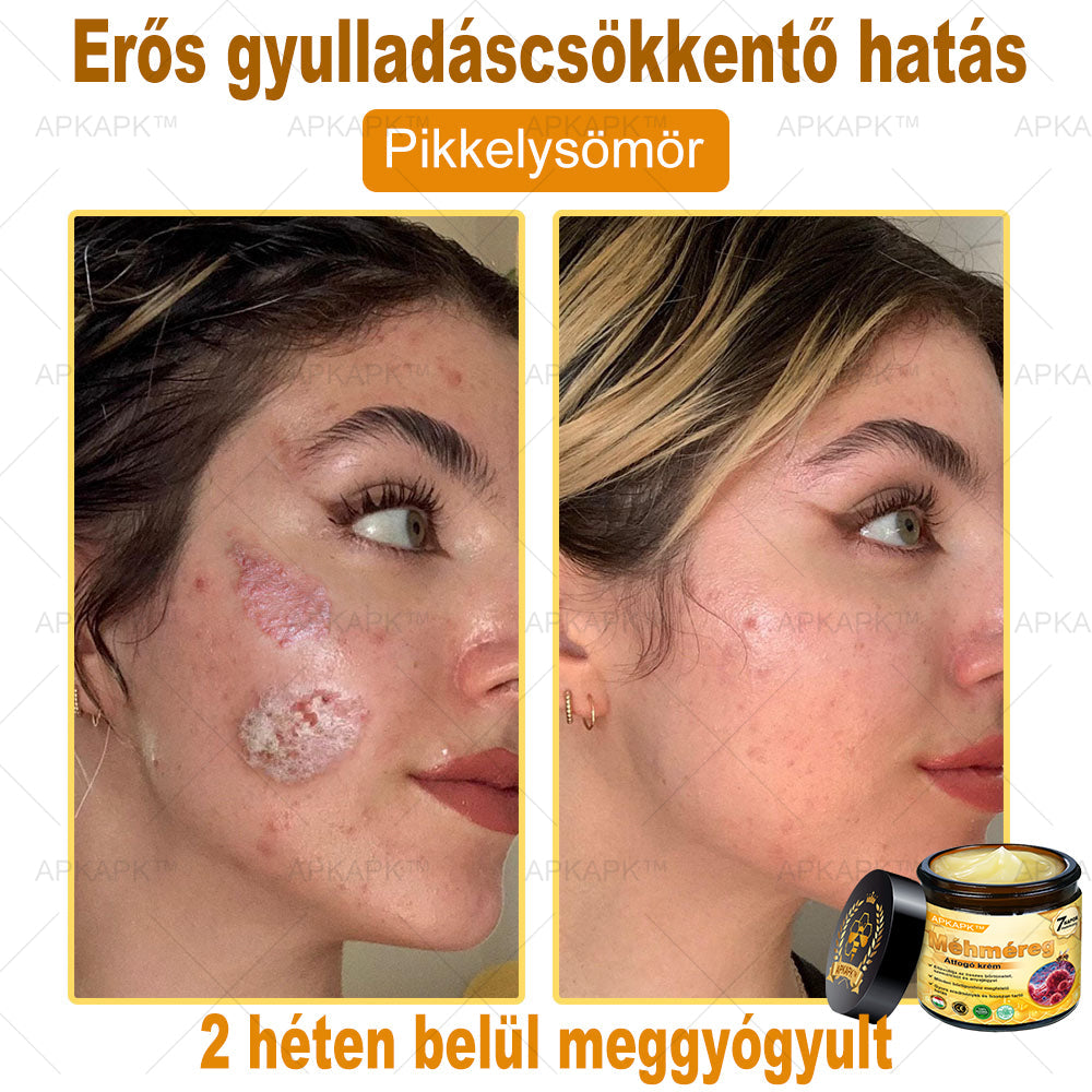 🎁 Már csak 5 doboz maradt! Most további 50% kedvezményt adunk! Legyél fitt és egészséges. Ha most nem élsz a lehetőséggel, legközelebb csak jövőre lesz rá esélyed!
