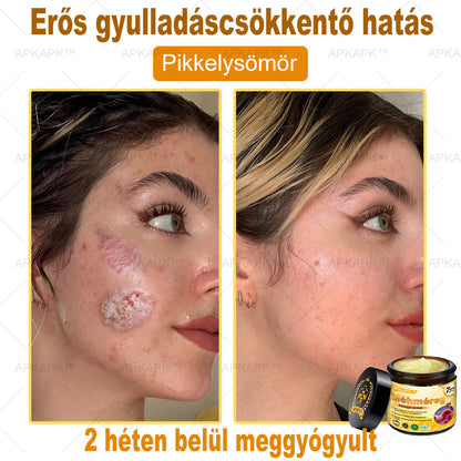 🎁 Már csak 5 doboz maradt! Most további 50% kedvezményt adunk! Legyél fitt és egészséges. Ha most nem élsz a lehetőséggel, legközelebb csak jövőre lesz rá esélyed!