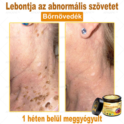 🎁 Már csak 5 doboz maradt! Most további 50% kedvezményt adunk! Legyél fitt és egészséges. Ha most nem élsz a lehetőséggel, legközelebb csak jövőre lesz rá esélyed!