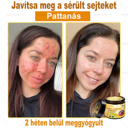 🎁 Már csak 5 doboz maradt! Most további 50% kedvezményt adunk! Legyél fitt és egészséges. Ha most nem élsz a lehetőséggel, legközelebb csak jövőre lesz rá esélyed!