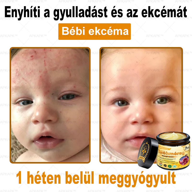 🎁 Már csak 5 doboz maradt! Most további 50% kedvezményt adunk! Legyél fitt és egészséges. Ha most nem élsz a lehetőséggel, legközelebb csak jövőre lesz rá esélyed!