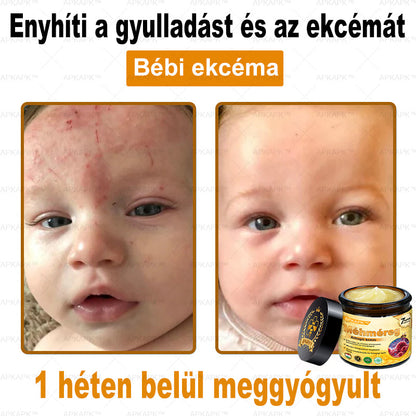 🎁 Már csak 5 doboz maradt! Most további 50% kedvezményt adunk! Legyél fitt és egészséges. Ha most nem élsz a lehetőséggel, legközelebb csak jövőre lesz rá esélyed!