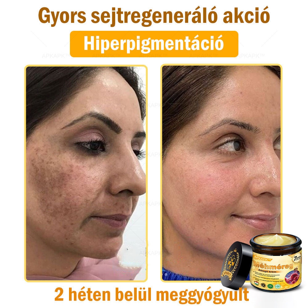 🎁 Már csak 5 doboz maradt! Most további 50% kedvezményt adunk! Legyél fitt és egészséges. Ha most nem élsz a lehetőséggel, legközelebb csak jövőre lesz rá esélyed!