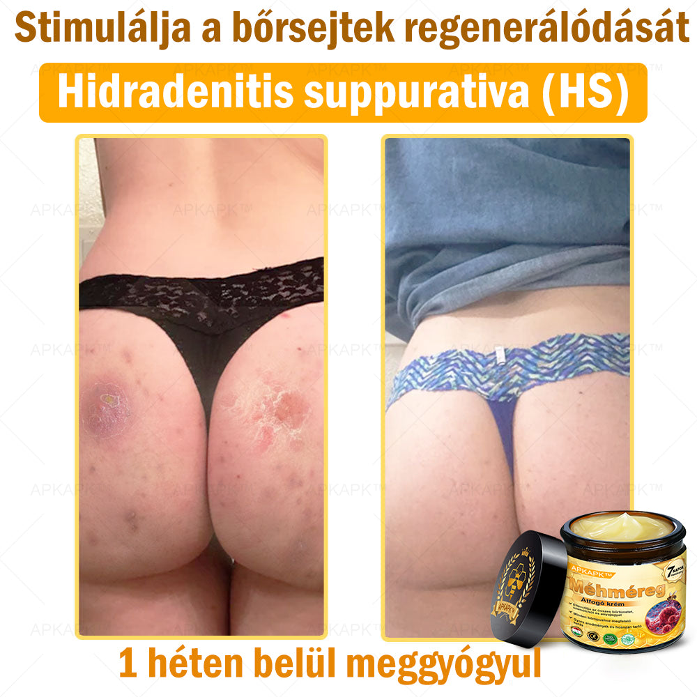 🎁 Már csak 5 doboz maradt! Most további 50% kedvezményt adunk! Legyél fitt és egészséges. Ha most nem élsz a lehetőséggel, legközelebb csak jövőre lesz rá esélyed!