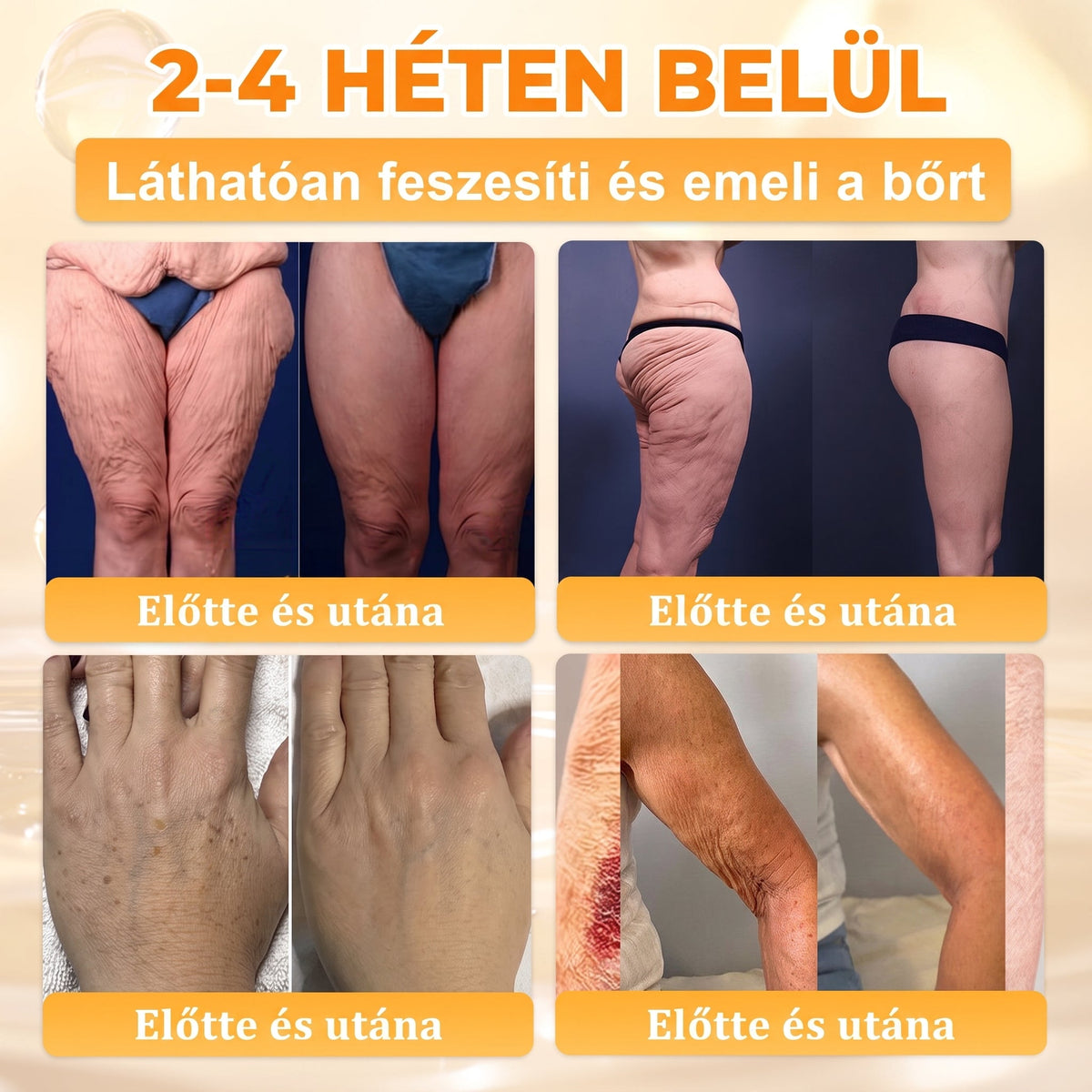 🎁 Már csak 5 doboz maradt! Most további 50% kedvezményt adunk! Legyél fitt és egészséges. Ha most nem élsz a lehetőséggel, legközelebb csak jövőre lesz rá esélyed!